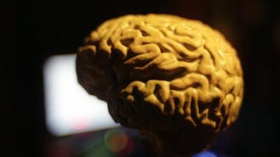Brain