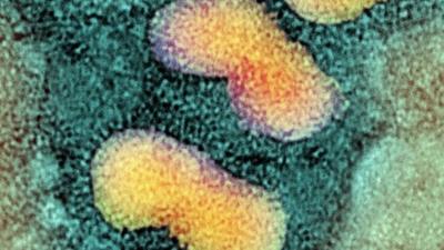 H5N1 avian influenza virus particles