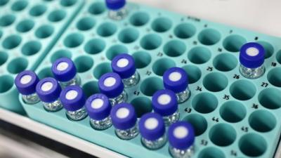 A tray of samples in the anti-doping laboratory