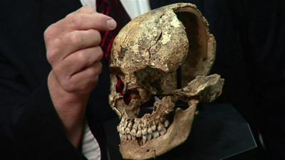 Man points at skull