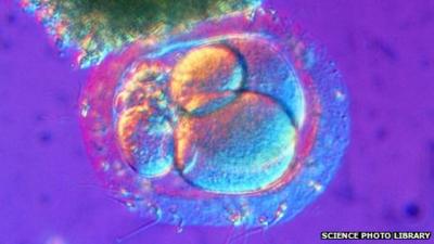 Light micrograph of fertilized human egg cell