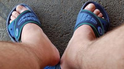 Legs