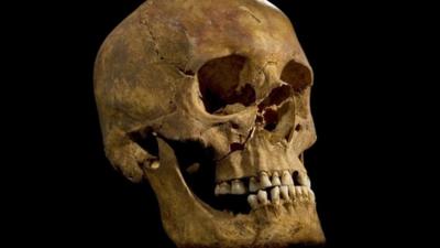 Skull of Richard III