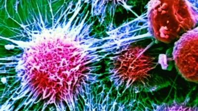 Kidney cancer cells