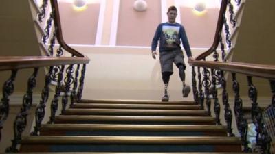 Gregg Stevenson using the stairs with prosthetics