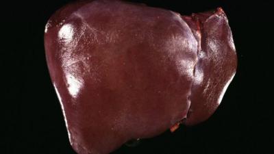 Healthy liver