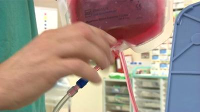 Hemosep blood transfusion technology being trialled at Nottingham City Hospital