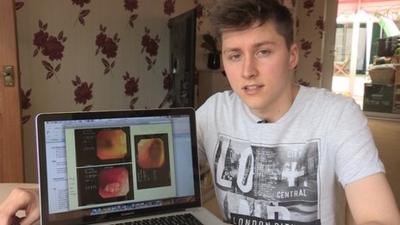 Crohn's sufferer Liam Ruff