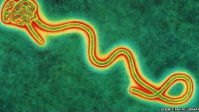 Coloured transmission electron micro graph of a single Ebola virus