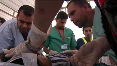 Medics treata child wounded in a UN-run school in Gaza after an Israeli attack in the area - 3 August 2014