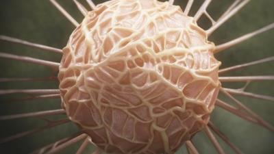 Breast cancer cell