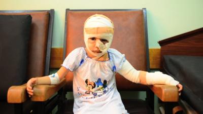 Gaza conflict: a child's injuries