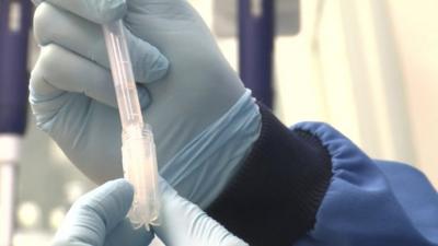 A medicine being put into a test tube with a pipette