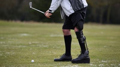 Man plays golf while using a bionic leg brace