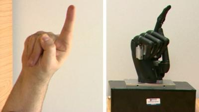 Human hand and bionic hand