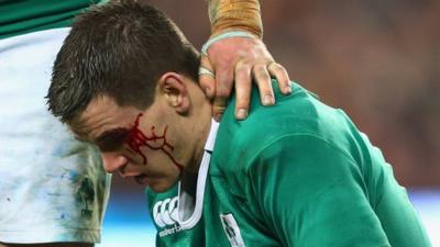 Ireland's Jonathan Sexton waits for treatment after clashing heads with France's Mathieu Bastareaud during the 2015 Six Nations