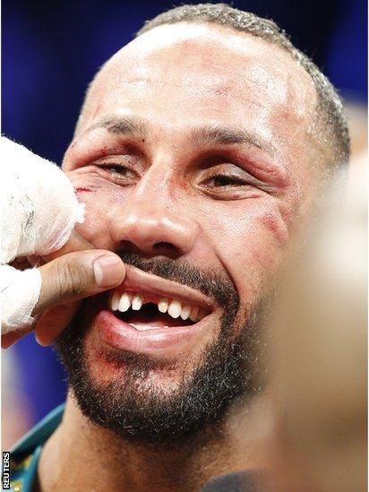 James DeGale