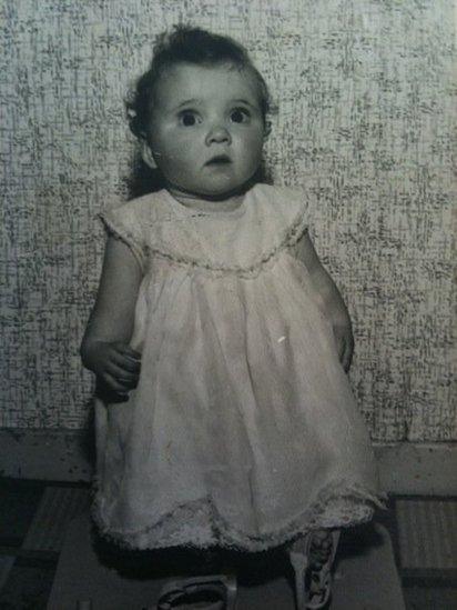 An old photograph of Kim Fenton as a baby. She was born with shortened arms and legs, deformed hands, no thumbs, no kneecaps and upside down feet.