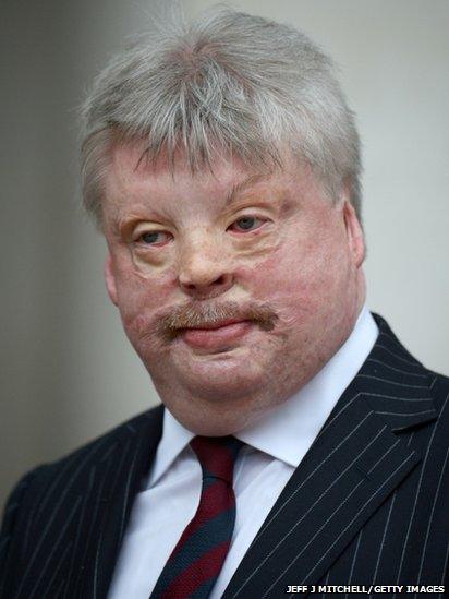 Simon Weston attends the Ceremonial funeral of former British Prime Minister Baroness Thatcher