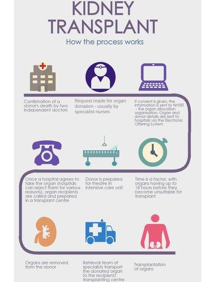 How the kidney transplant process works