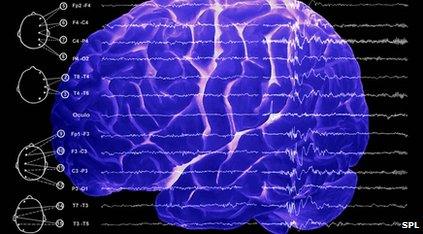 electroencephalograph