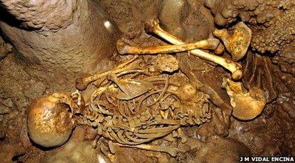 Bones of the 7,000-year-old man