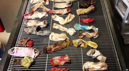 A photo shows a handful of the socks that were removed from the dog's stomach