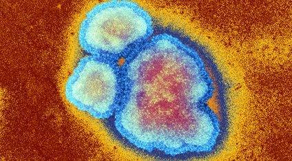 Measles virus