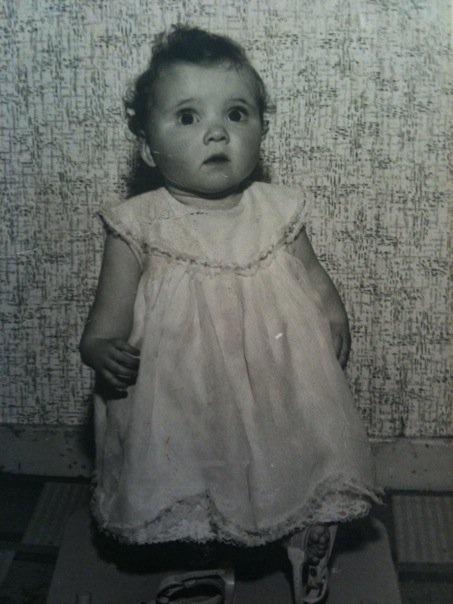 An old photograph of Kim Fenton as a baby. She was born with shortened arms and legs, deformed hands, no thumbs, no kneecaps and upside down feet.