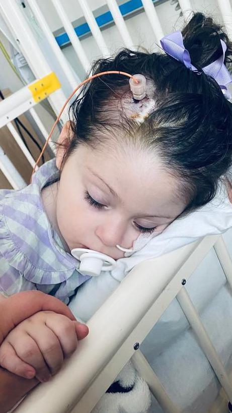 Amber in a hospital bed, with a medical tube inserted into her head. She is asleep. One of her hands is being held by someone who is off camera.