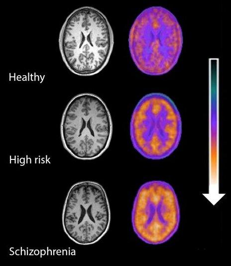 Brain scans