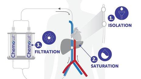 Chemosaturation