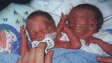 Two tiny babies are wrapped in a pale blue knitted blanket. Both are snuggled close to each other and have breathing tubes in their noses. The baby on the left has a white dummy in its mouth which is being rested there by an adult hand.