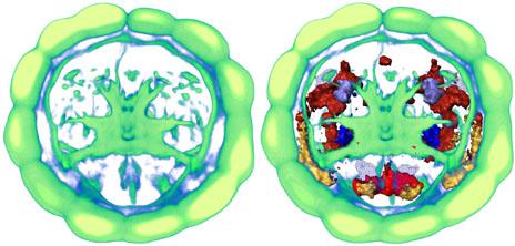 Platynereis brain (EMBL/R.Tomer)