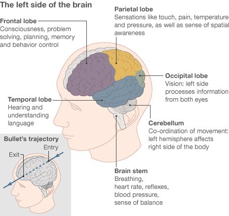 Infographic showing bullet trajectory and brain functions