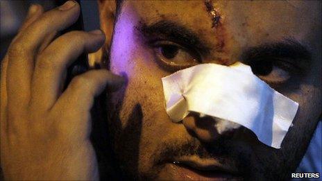 Anti-government demonstrator, wounded during clashes with pro-government protesters, makes a call from his mobile