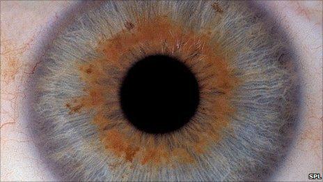 Eye