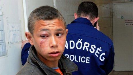 Roma youth injured in Gyongyospata clash, 27 Apr 11