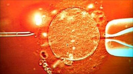 IVF treatment