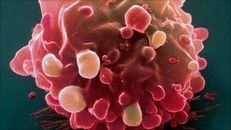 Bowel cancer cell