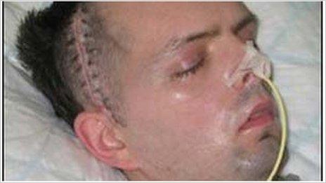 Derry civil servant Paul McCauley after he was beaten up in a sectarian attack in July 2006