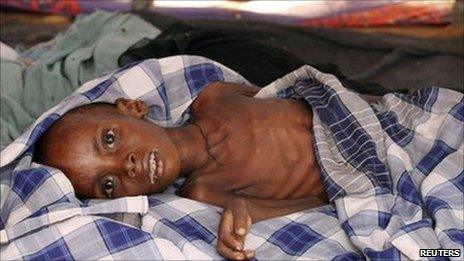 A child at a refugee camp in Mogadishu (July 2011)