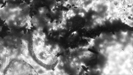 Parts of two microfossils