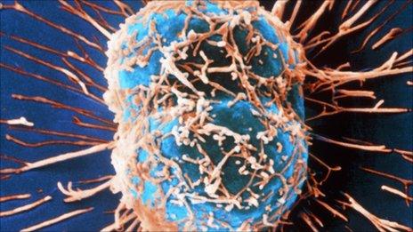 Cervical cancer cells