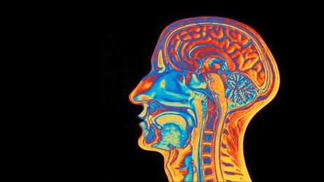 Colourised MRI brain scan