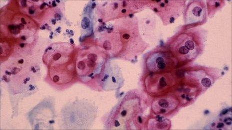 HPV on a smear