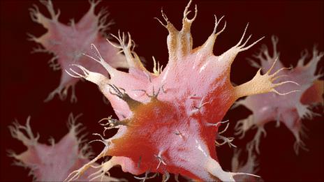 Dendritic cell