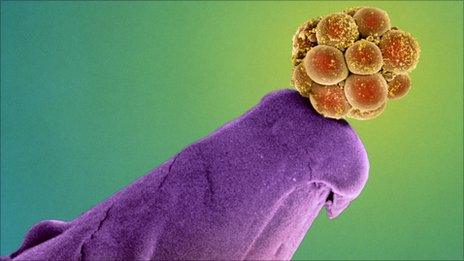 Embryo on the head of a pin