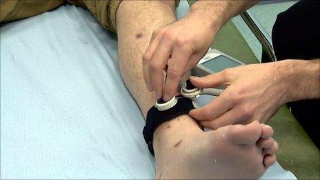 Patient's leg fitted with equipment to use ultrasound