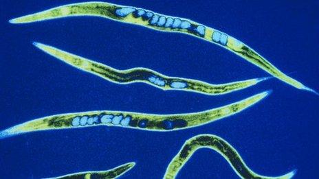 Nematode worms (Credit: SPL)